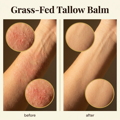Beef Tallow for Skin (Vanilla) - 100% Grass-Fed Tallow Balm & Moisturizer for Face & Body